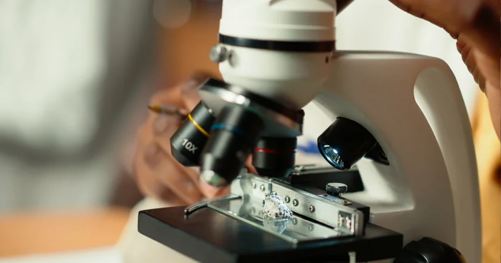 espermatozoides visualizados em exame de espermograma