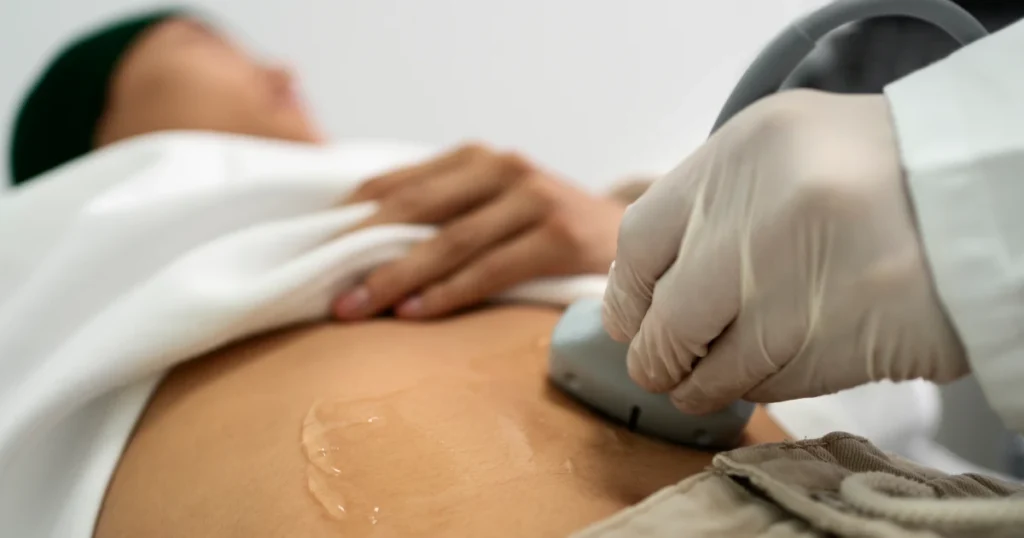 ultrassonografia demonstrando varicocele